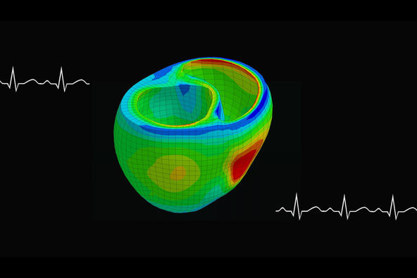 heart%20model2edited_0.jpg