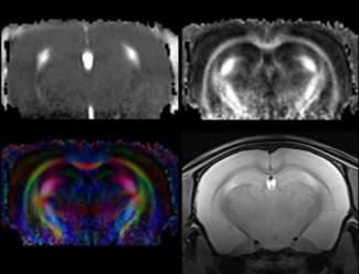 Diffusion Tensor imaging 1