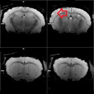 stroke in a mouse brain