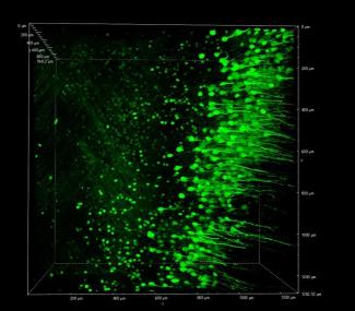 lightmicroscan4